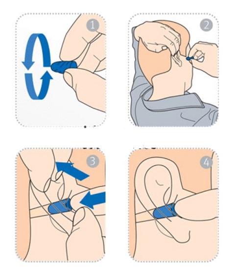 Nút tai cần phải dễ dàng sử dụng và vệ sinh